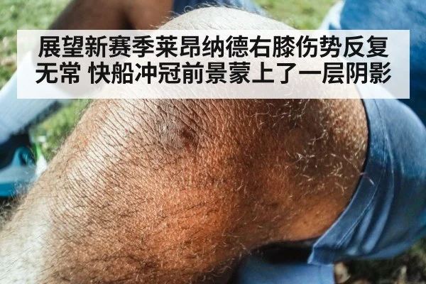 展望新赛季莱昂纳德右膝伤势反复无常 快船冲冠前景蒙上了一层阴影